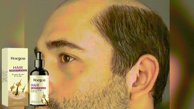 648b17c8-70ca-459e-8b4d-b09f2fd8a6bc